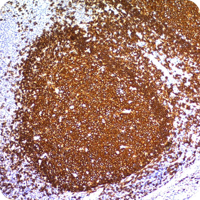 CD20 / MS4A1 (B-Cell Marker); Clone IGEL/773 (Concentrate)